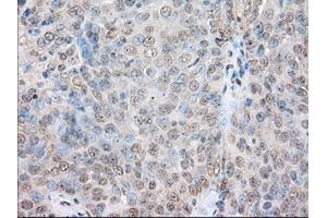 Immunohistochemical staining of paraffin-embedded Human colon tissue using anti-SNX9 mouse monoclonal antibody.