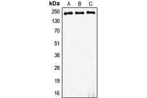 Western blot analysis of Myosin 8 expression in HeLa (A), SP2/0 (B), PC12 (C) whole cell lysates. (MYH8 anticorps  (Center))