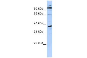 WB Suggested Anti-PHF11 Antibody Titration:  0. (PHF11 anticorps  (N-Term))
