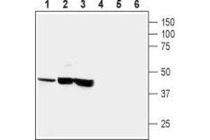 Western blot analysis of human neuroblastoma (SH-SY5Y) (lanes 1 and 4), human brain astrocytoma (CCF-STTGI) (lanes 2 and 5) and rat pheochromocytoma (PC12) (lanes 3 and 6): - 1-3. (CRHR1 anticorps  (Extracellular, N-Term))