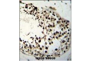 LIN28A Antibody (Center) (ABIN655156 and ABIN2844774) immunohistochemistry analysis in formalin fixed and paraffin embedded human testis tissue followed by peroxidase conjugation of the secondary antibody and DAB staining.