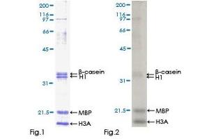 Kinase Activity Assay (KAA) image for Calcium/calmodulin-Dependent Protein Kinase Kinase 1, alpha (CAMKK1) (AA 1-520) protein (GST tag) (ABIN1347943)