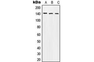 Western blot analysis of Beta Amyloid (pT743) expression in MCF7 colchicine-treated (A), mouse liver (B), PC12 (C) whole cell lysates. (beta Amyloid anticorps  (C-Term, pSer743))