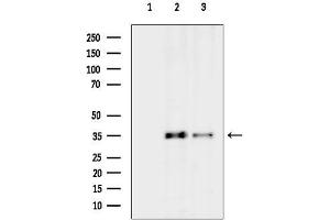 anti-Peroxisomal Biogenesis Factor 14 (PEX14) (Internal Region) antibody