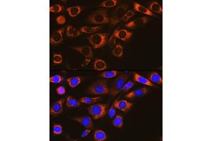 Immunofluorescence analysis of NIH-3T3 cells using F Rabbit mAb (ABIN1682600, ABIN3018533, ABIN3018534 and ABIN7101623) at dilution of 1:100 (40x lens).