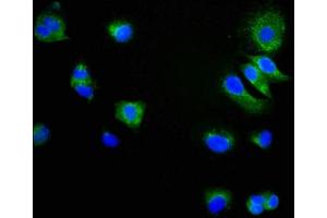 Immunofluorescence staining of MCF-7 cells with ABIN7127286 at 1:34,counter-stained with DAPI.