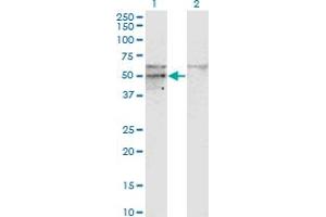Western Blot analysis of SC65 expression in transfected 293T cell line by SC65 monoclonal antibody (M01), clone 1E12.