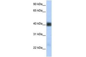 Image no. 1 for anti-Sarcoglycan, beta (43kDa Dystrophin-Associated Glycoprotein) (SGCB) (AA 180-229) antibody (ABIN6740863) (SGCB anticorps  (AA 180-229))