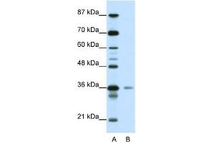 WB Suggested Anti-HMG20A Antibody Titration:  0. (HMG20A anticorps  (C-Term))