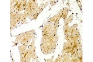 Immunohistochemistry of paraffin-embedded Human esophagus using MVP Polyclonal Antibody at dilution of 1:100 (40x lens). (MVP anticorps)