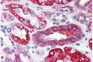 Human Kidney (formalin-fixed, paraffin-embedded) stained with SCO2 antibody ABIN214472 at 2. (SCO2 anticorps  (C-Term))