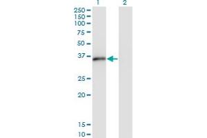 Western Blot analysis of MSX2 expression in transfected 293T cell line by MSX2 monoclonal antibody (M10), clone 1E8. (Msx2/Hox8 anticorps  (AA 1-133))