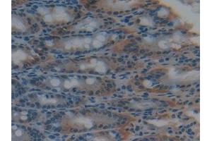 Detection of GSTk1 in Mouse Intestine Tissue using Polyclonal Antibody to Glutathione S Transferase Kappa 1 (GSTk1)