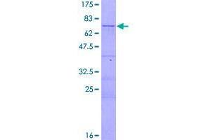 Image no. 1 for Centromere Protein J (CENPJ) (AA 1-372) protein (GST tag) (ABIN1349116)