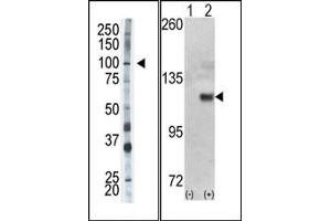 Image no. 1 for anti-Hexokinase 1 (HK1) (N-Term) antibody (ABIN360644) (Hexokinase 1 anticorps  (N-Term))