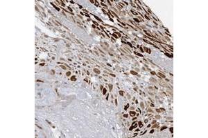 Immunohistochemical staining of human placenta with PGBD2 polyclonal antibody  shows strong positivity in decidual cells at 1:10-1:20 dilution. (PGBD2 anticorps)