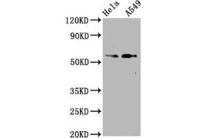 Western Blot Positive WB detected in Hela whole cell lysate,A549 whole cell lysate All lanes Phospho-SMAD2 antibody at 1. (Recombinant SMAD2 anticorps  (pSer250))