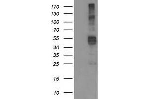 Western Blotting (WB) image for anti-Transmembrane Protease, serine 5 (TMPRSS5) antibody (ABIN1501445)