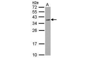 Image no. 1 for anti-Regulation of Nuclear Pre-mRNA Domain Containing 1A (RPRD1A) (AA 103-312) antibody (ABIN1500758) (RPRD1A anticorps  (AA 103-312))
