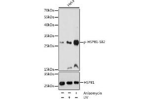Western blot analysis of extracts of HeLa cells using Phospho-HSPB1(S82) Polyclonal Antibody at dilution of 1:1000. (HSP27 anticorps  (pSer82))