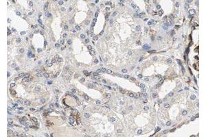 ABIN6277788 at 1/100 staining Human kidney tissue by IHC-P.