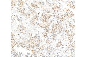 Immunohistochemistry (IHC) image for anti-Cullin 4A (CUL4A) (C-Term) antibody (ABIN7453591) (Cullin 4A anticorps  (C-Term))