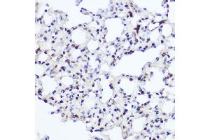 Immunohistochemistry of paraffin-embedded rat lung using NFIA Rabbit pAb (ABIN1681040, ABIN3017626, ABIN3017627 and ABIN6220178) at dilution of 1:200 (40x lens). (NFIA anticorps  (AA 180-330))