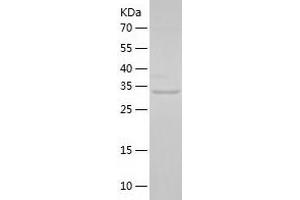 Western Blotting (WB) image for 3'(2'), 5'-Bisphosphate Nucleotidase 1 (BPNT1) (AA 1-308) protein (His tag) (ABIN7121617) (BPNT1 Protein (AA 1-308) (His tag))