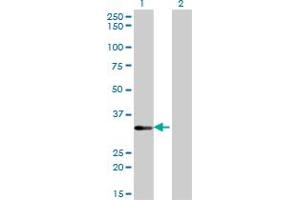 Western Blot analysis of STK16 expression in transfected 293T cell line by STK16 monoclonal antibody (M02), clone M2.