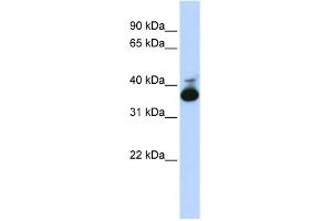 WB Suggested Anti-ALDOB Antibody Titration:  0. (ALDOB anticorps  (Middle Region))