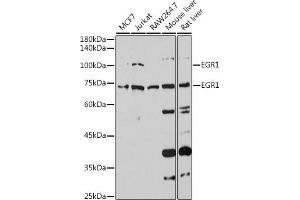 Western blot analysis of extracts of various cell lines, using EGR1 antibody (ABIN3016527, ABIN3016528, ABIN3016529 and ABIN1679679) at 1:1000 dilution. (EGR1 anticorps)