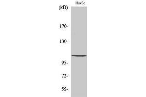 Western Blotting (WB) image for anti-Histone Deacetylase 7 (HDAC7) (C-Term) antibody (ABIN3175495) (HDAC7 anticorps  (C-Term))