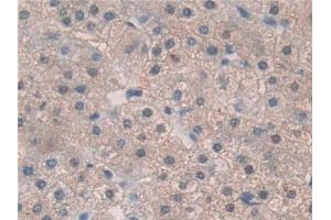 Detection of TPO in Human Liver Tissue using Polyclonal Antibody to Thrombopoietin (TPO)