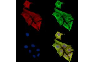 ABIN7097103 and ABIN7101170 staining Hela cells by IF/ICC. (Dolichol Kinase anticorps)