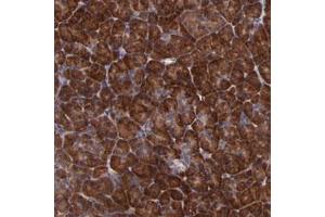 Immunohistochemical staining of human pancreas with USP51 polyclonal antibody  shows strong cytoplasmic positivity in exocrine glandular cells at 1:50-1:200 dilution.