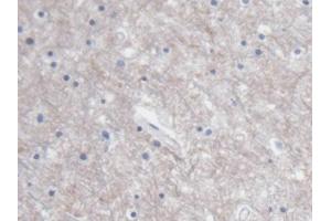 IHC-P analysis of Human Cerebrum Tissue, with DAB staining. (S100B anticorps  (AA 1-92))