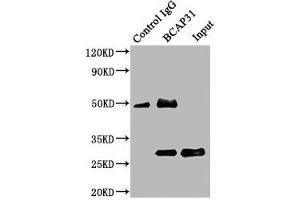 Immunoprecipitating BCAP31 in Mouse liver tissue Lane 1: Rabbit control IgG (1 μg) instead of ABIN7145178 in Mouse liver tissue.