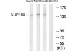 Western blot analysis of extracts from NIH-3T3/A549/HepG2 cells, using NUP160 Antibody. (NUP160 anticorps  (AA 392-441))