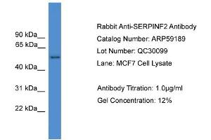 WB Suggested Anti-SERPINF2  Antibody Titration: 0. (alpha 2 Antiplasmin anticorps  (N-Term))