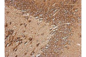IHC-P Image Immunohistochemical analysis of paraffin-embedded CL1-5 xenograft, using RPL29, antibody at 1:500 dilution. (RPL29 anticorps)