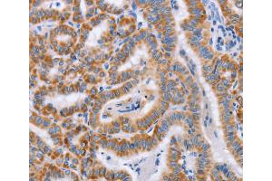 Immunohistochemistry (IHC) image for anti-Bone Marrow Stromal Cell Antigen 1 (BST1) antibody (ABIN2434360) (BST1 anticorps)