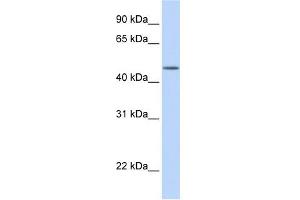 TBL2 antibody used at 1 ug/ml to detect target protein.