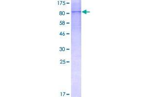 Image no. 1 for B Lymphoid Tyrosine Kinase (BLK) (AA 1-505) protein (GST tag) (ABIN1346709)