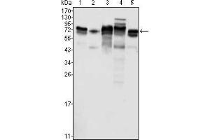 Western blot analysis using Metadherin mouse mAb against K562 (1), SKBR-3 (2), T47D (3), Hela (4) and MCF-7 (5) cell lysate. (MTDH anticorps)
