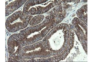 Image no. 3 for anti-Polymerase (RNA) III (DNA Directed) Polypeptide C (62kD) (POLR3C) antibody (ABIN1500340)