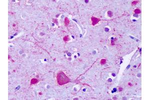 Anti-GPR75 antibody IHC of human brain, cortex, neurons. (GPR75 anticorps  (C-Term))