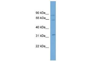CAPN11 antibody used at 0. (CAPN11 anticorps  (N-Term))