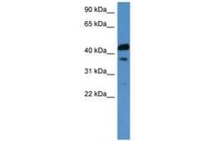 Image no. 1 for anti-Calcitonin Receptor (CALCR) (C-Term) antibody (ABIN6746629) (Calcitonin Receptor anticorps  (C-Term))