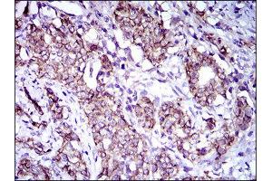 Immunohistochemistry (IHC) image for anti-Activated Leukocyte Cell Adhesion Molecule (ALCAM) (AA 48-216) antibody (ABIN1846222) (CD166 anticorps  (AA 48-216))