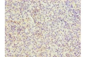 anti-Integrin alpha-L (ITGAL) (AA 201-500) antibody